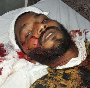 Bhopal Crime News